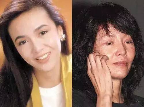 香港最老明星整容失败照片对比,整容失败的明星有哪些