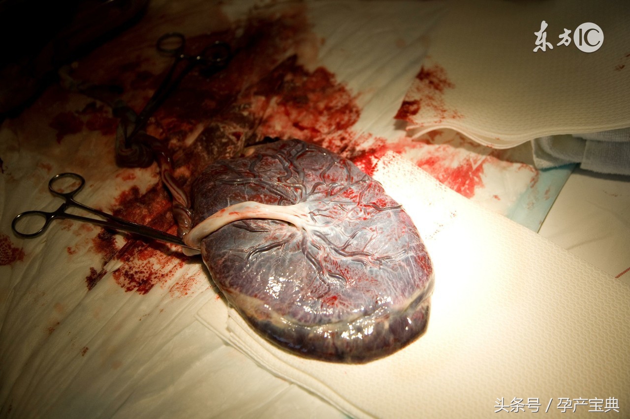 孕期什么症状都没有正常吗,孕期什么症状不能要孩子