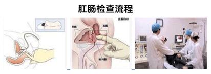 痔疮患者需要知道的必要事项,真正快速治好痔疮的方法