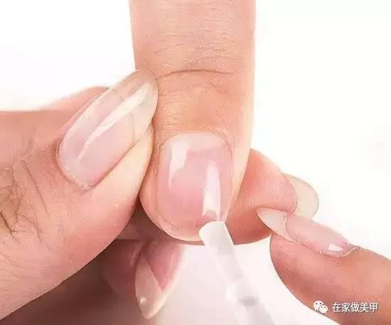 玛蒂被折断手指,玛蒂折断手指