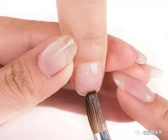 玛蒂被折断手指,玛蒂折断手指