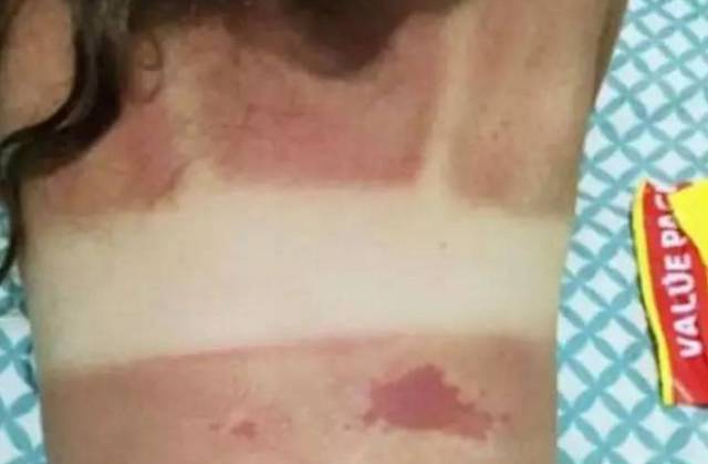 儿童防晒有哪些坑点,被曝光儿童防晒