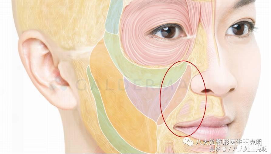 杨紫的法令纹能消除吗,杨紫法令纹很深怎么回事