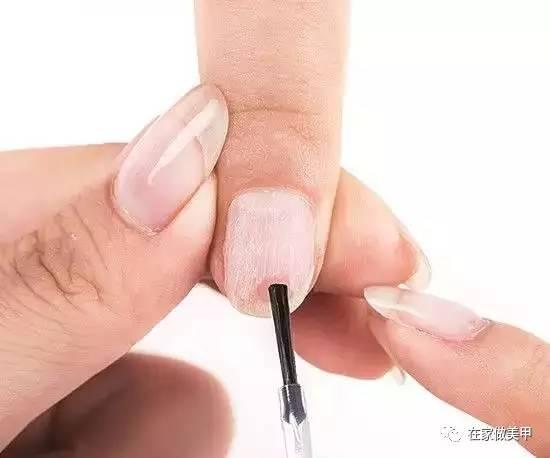 玛蒂被折断手指,玛蒂折断手指