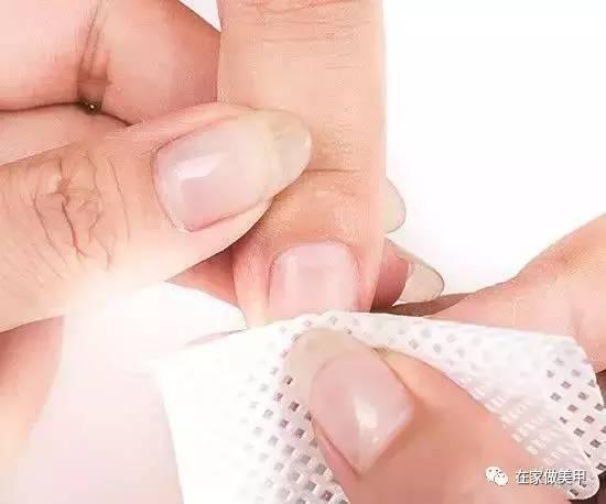 玛蒂被折断手指,玛蒂折断手指