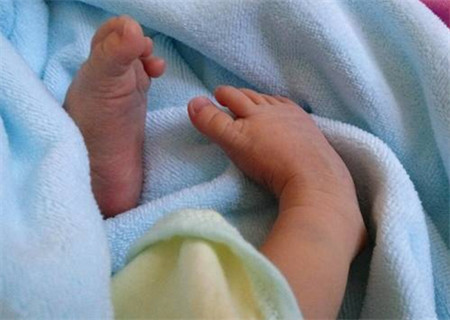 四维双足内翻宝宝能不能要,四维查出胎儿足内翻后期会长好吗