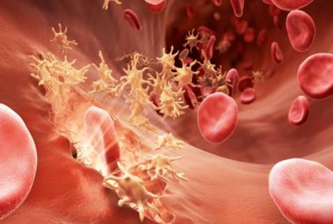 有血友病遗传生孩子有什么危险,一受伤就血流不止的病叫什么