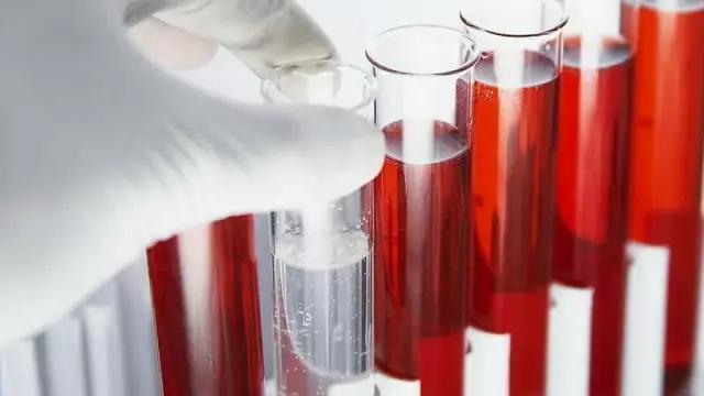 血液病最有价值的检查方法,20块钱体检项目