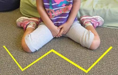 怎么坐改善驼背,宝宝怎么坐起来不伤腰