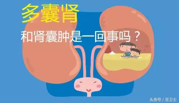 多囊肾和多发性肾囊肿是一回事吗,肾囊肿与多囊肾是一回事吗