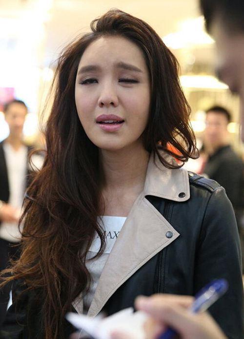 夏天吹风扇面瘫怎么办,电扇吹的面瘫怎么治