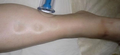 产后瘦腿瘦肚子视频,产后怎样瘦腿和屁股