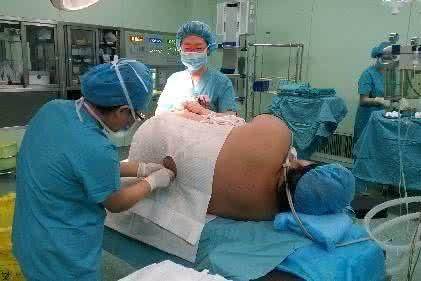 体重200斤的孕妇生孩子，医生说孩子像是在脂肪里抱出来的！