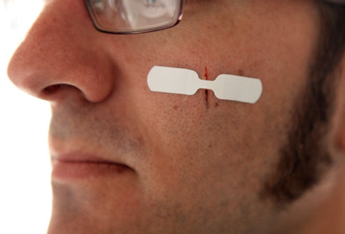 伤口被割伤并且被烫伤了怎么办,意外烫伤的最佳方法