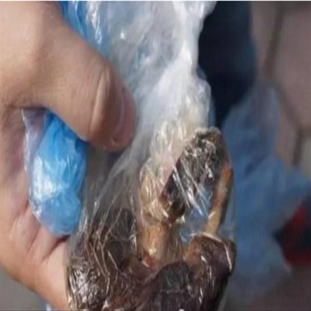 剖腹产20多年经常肚子胀吃什么药,剖腹产后一直肚子很大