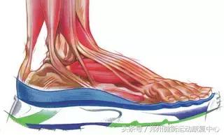足底筋膜炎康复治疗,高足弓足底筋膜炎康复