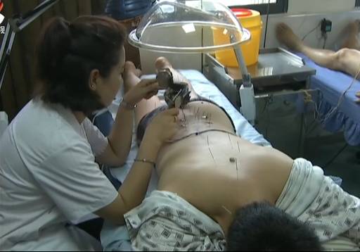 陈日新：持“灸”不息让中医再发力