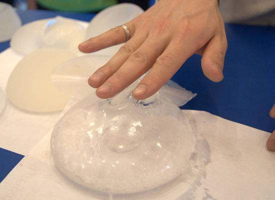 隆胸之后还可以哺乳么,隆胸了还会奶涨吗