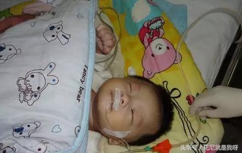 奶粉泡太浓致小宝宝肠子坏死,奶奶给宝宝喝错奶粉