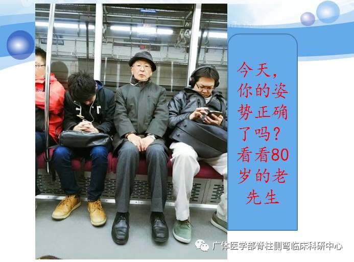 脊柱侧弯暑期训练营招募,脊柱侧弯夏令营视频