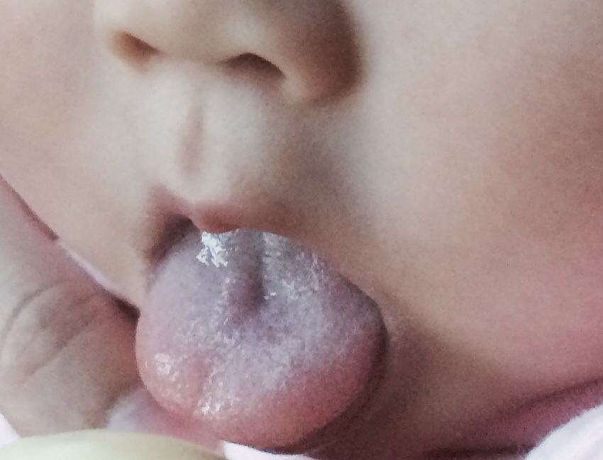 宝宝吃母乳舌苔黄是怎么回事,母乳宝宝舌苔白厚需要清理吗