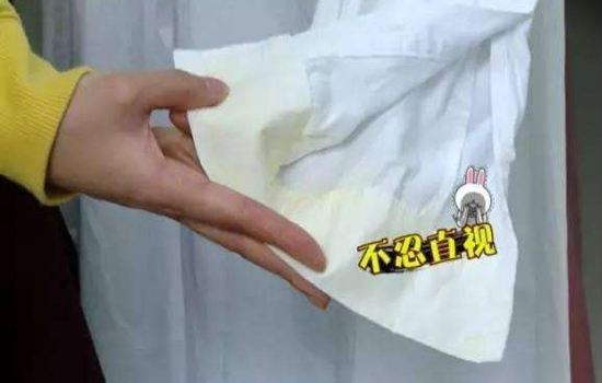 双氧水可以洗掉衣服上的黄渍吗,衣服发黄怎么清洗才能变白