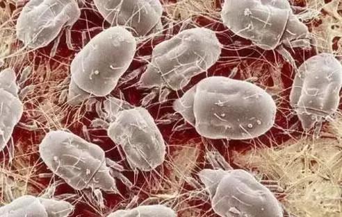 祛除黑头粉刺痘痘螨虫收缩毛孔,鼻子黑头多脸上毛孔大是螨虫