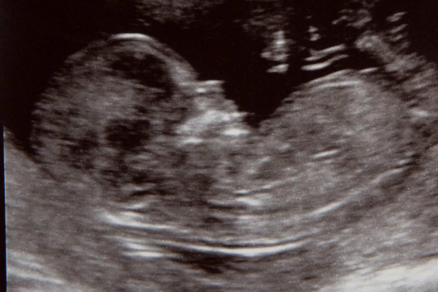 准妈妈必看孕期运动关注事项,孕期1-40周检查表明细表