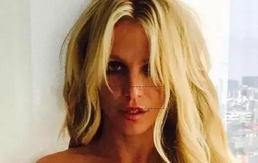 爱笑的人会有属于自己的法令纹,天生法令纹就很深怎么办又不爱笑