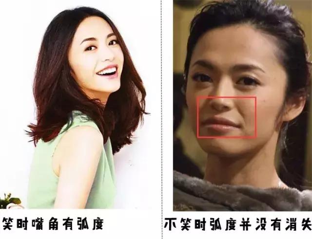 爱笑的人会有属于自己的法令纹,天生法令纹就很深怎么办又不爱笑