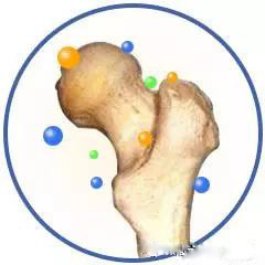 45岁股骨头坏死2期换什么样假体好,如何治疗股骨头坏死有效