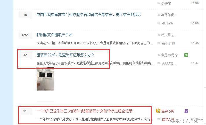 胆结石治疗方法和关注事项,胆结石正确治疗方法