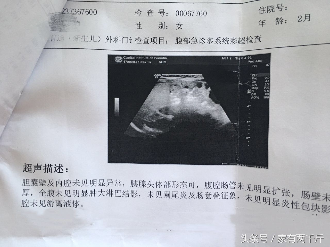 宝宝莫名哭闹谨慎是肠绞痛,宝宝异常哭闹睡不踏实