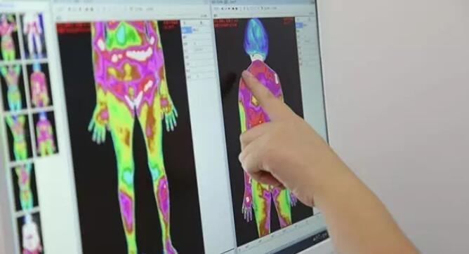 45岁股骨头坏死2期换什么样假体好,如何治疗股骨头坏死有效