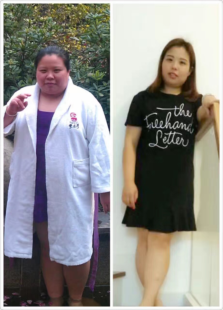 难怪你这么胖，经络都堵了