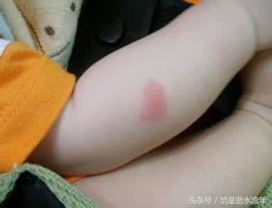 被蚊虫叮咬红肿有小红块怎么解决,宝宝蚊虫叮咬后红肿严重怎么办