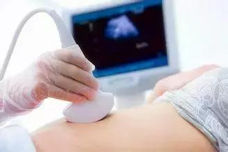妇科检查的那些事儿,妇科彩色多普勒超声检查