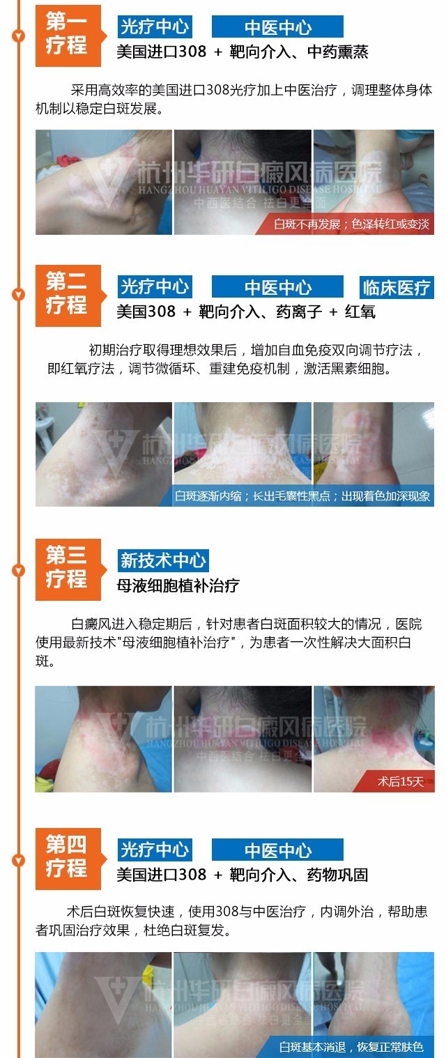 白癜风有没自愈的病例,白癜风治愈一百例