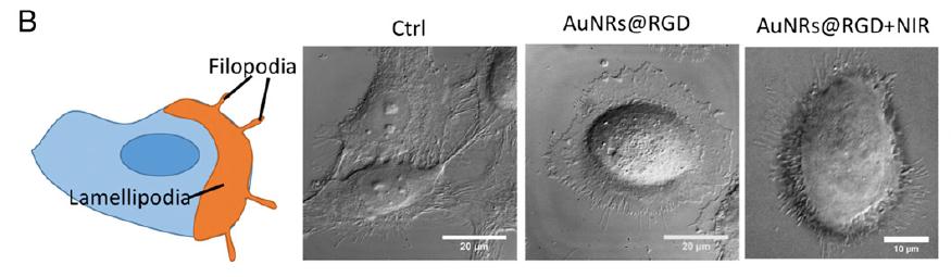 PNAS阻止癌症转移新*器武**：纳米材料+激光打断癌细胞的“腿”