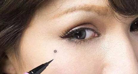 身上长痣谨慎癌变,身上的痣会癌变吗