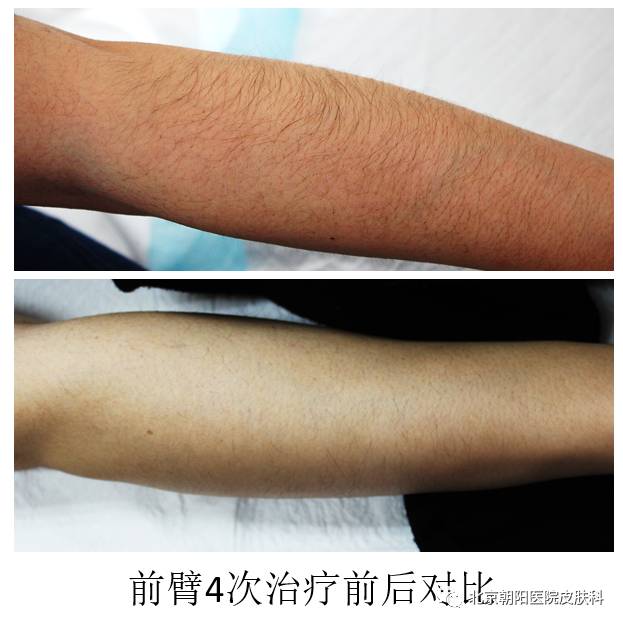 聊一聊护肤的那些事儿,聊一聊减重那些事儿