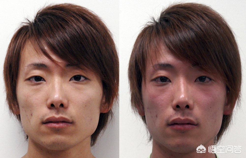 酒喝多了几天才能完全恢复,喝多了酒第二天怎么快速恢复