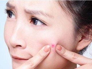 身体上粉刺很大很硬怎么去除,怎样解决皮肤里的粉刺