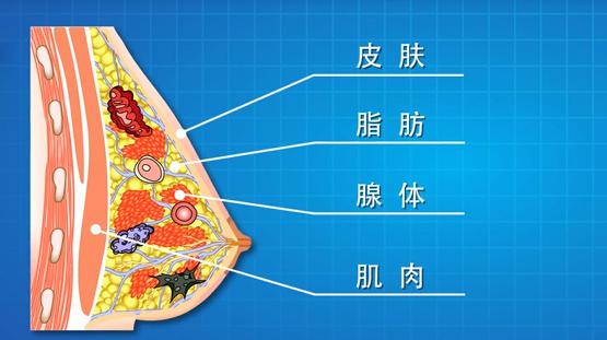 乳腺活检穿刺术操作方法,乳腺活检是怎么弄的