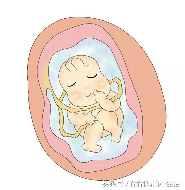 脐带绕颈一周还是臀位,脐绕颈两圈怎么绕过来