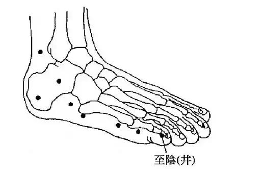 混合臀位如何转正,怎么扭转臀位