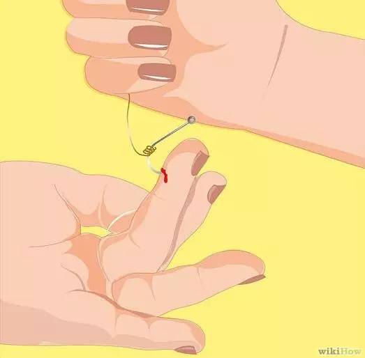 鱼钩钩到手指怎么办,鱼钩钩住手会得破伤风吗