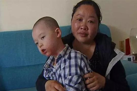 宝宝湿疹安全的偏方,宝宝湿疹用药好了之后怎么预防