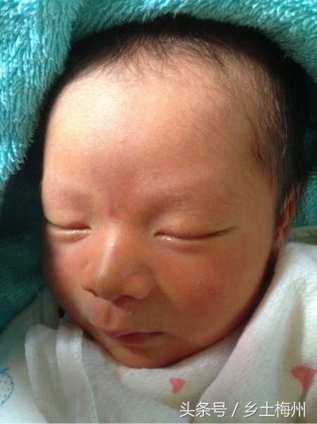 小孩长痱子能用艾草水洗吗,一岁宝宝长痱子可以洗十滴水吗