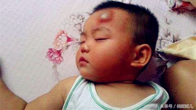 宝宝脑袋磕破了怎么办,宝宝脑袋磕了一个小包怎么办